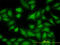 MAP kinase-interacting serine/threonine-protein kinase 1 antibody, LS-C133554, Lifespan Biosciences, Immunofluorescence image 