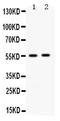 Aldh3 antibody, LS-C662450, Lifespan Biosciences, Western Blot image 