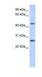 PRAME Family Member 10 antibody, NBP1-56432, Novus Biologicals, Western Blot image 