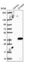 Dynactin Associated Protein antibody, PA5-52799, Invitrogen Antibodies, Western Blot image 