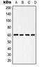 Heat Shock Protein Family D (Hsp60) Member 1 antibody, orb214066, Biorbyt, Western Blot image 