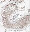 Mitochondrial Ribosomal Protein L36 antibody, FNab05329, FineTest, Immunohistochemistry paraffin image 