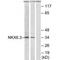 NK6 Homeobox 3 antibody, A13786, Boster Biological Technology, Western Blot image 