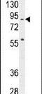 Spire Type Actin Nucleation Factor 2 antibody, PA5-24099, Invitrogen Antibodies, Western Blot image 