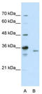 Exosome complex exonuclease RRP40 antibody, TA343836, Origene, Western Blot image 