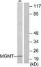 Cyclin-dependent kinase 5 activator 2 antibody, TA314841, Origene, Western Blot image 