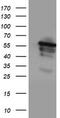 Cytochrome P450 Family 2 Subfamily A Member 6 antibody, TA503827S, Origene, Western Blot image 
