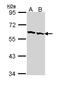 Chaperonin Containing TCP1 Subunit 2 antibody, LS-B4861, Lifespan Biosciences, Western Blot image 