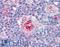 Intercellular Adhesion Molecule 1 antibody, LS-B1850, Lifespan Biosciences, Immunohistochemistry frozen image 