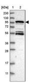 Round Spermatid Basic Protein 1 Like antibody, NBP1-81903, Novus Biologicals, Western Blot image 