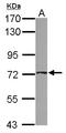 ATP Binding Cassette Subfamily D Member 4 antibody, LS-C155389, Lifespan Biosciences, Western Blot image 
