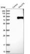 Polypeptide N-acetylgalactosaminyltransferase 6 antibody, HPA017086, Atlas Antibodies, Western Blot image 