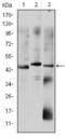 Orthodenticle Homeobox 2 antibody, GTX60448, GeneTex, Western Blot image 