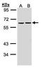 Zinc finger protein with KRAB and SCAN domains 3 antibody, TA308508, Origene, Western Blot image 
