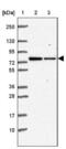 Zinc finger protein 471 antibody, NBP2-38092, Novus Biologicals, Western Blot image 