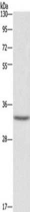 Centromere Protein H antibody, TA349789, Origene, Western Blot image 