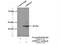Alcohol Dehydrogenase Iron Containing 1 antibody, 19359-1-AP, Proteintech Group, Immunoprecipitation image 