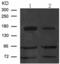 Integrin alpha-4 antibody, TA321223, Origene, Western Blot image 