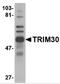Tripartite motif-containing protein 30 antibody, 4745, ProSci Inc, Western Blot image 