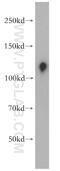 Ubiquitin Specific Peptidase 38 antibody, 17767-1-AP, Proteintech Group, Western Blot image 