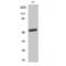 PLAG1 Like Zinc Finger 1 antibody, LS-C386685, Lifespan Biosciences, Western Blot image 
