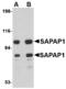 Disks large-associated protein 1 antibody, LS-C53309, Lifespan Biosciences, Western Blot image 