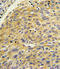 Cytosolic phospholipase A2 antibody, LS-C163759, Lifespan Biosciences, Immunohistochemistry paraffin image 