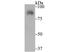 Sad1 And UNC84 Domain Containing 2 antibody, NBP2-75696, Novus Biologicals, Western Blot image 