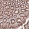Zinc Finger BED-Type Containing 5 antibody, NBP2-13533, Novus Biologicals, Immunohistochemistry paraffin image 