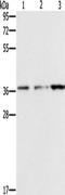 NSE3 Homolog, SMC5-SMC6 Complex Component antibody, TA350933, Origene, Western Blot image 