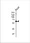 Ubiquitin carboxyl-terminal hydrolase 22 antibody, TA324831, Origene, Western Blot image 