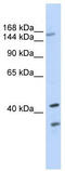 ATP Binding Cassette Subfamily C Member 8 antibody, TA332362, Origene, Western Blot image 