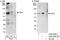 Yes Associated Protein 1 antibody, A302-308A, Bethyl Labs, Immunoprecipitation image 