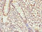Ubiquitin Specific Peptidase 26 antibody, LS-C676692, Lifespan Biosciences, Immunohistochemistry paraffin image 