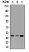 Serpin Family B Member 3 antibody, LS-C358304, Lifespan Biosciences, Western Blot image 