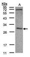 Chloride Intracellular Channel 3 antibody, PA5-21568, Invitrogen Antibodies, Western Blot image 