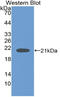 Neuroglobin antibody, LS-C314562, Lifespan Biosciences, Western Blot image 
