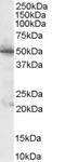 Pyruvate Dehydrogenase Complex Component X antibody, STJ70692, St John