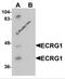 Transmembrane Serine Protease 11A antibody, 6521, ProSci, Western Blot image 