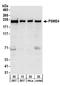 Proteasome Activator Subunit 4 antibody, A303-880A, Bethyl Labs, Western Blot image 