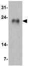GLIPR1 Like 1 antibody, GTX31905, GeneTex, Western Blot image 