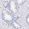 G antigen family B member 1 antibody, HPA003473, Atlas Antibodies, Immunohistochemistry paraffin image 