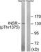 Insulin Receptor antibody, TA313224, Origene, Western Blot image 