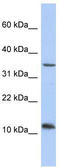 Nucleoredoxin Like 2 antibody, TA340407, Origene, Western Blot image 