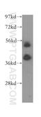 ATPase H+ Transporting V1 Subunit C2 antibody, 16274-1-AP, Proteintech Group, Western Blot image 
