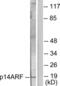 CDKN2A antibody, LS-C118541, Lifespan Biosciences, Western Blot image 