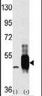 Mitogen-activated protein kinase kinase kinase 8 antibody, PA5-15094, Invitrogen Antibodies, Western Blot image 