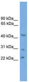MOK Protein Kinase antibody, TA345115, Origene, Western Blot image 