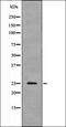 Linker For Activation Of T Cells Family Member 2 antibody, orb335946, Biorbyt, Western Blot image 