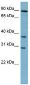 Nuclear Receptor Interacting Protein 3 antibody, TA339740, Origene, Western Blot image 